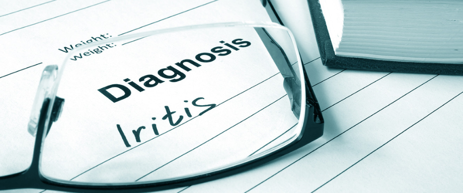 Diabetes and eyes – Diagnosis of Iritis